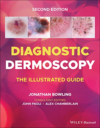 Book cover with four dermoscopy images and title Diagnostic Dermoscopy The Illustrated Guide.