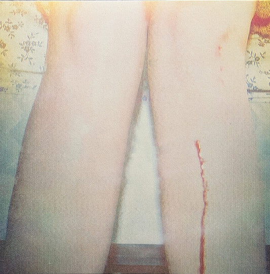 Two legs with a visible cut, floral wallpaper in background.