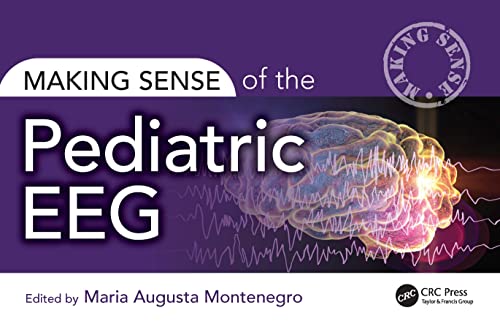 Book cover for Making Sense of the Pediatric EEG featuring a brain and waveforms.