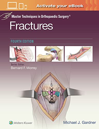 Book cover: "Fractures," fourth edition, with surgical illustrations.