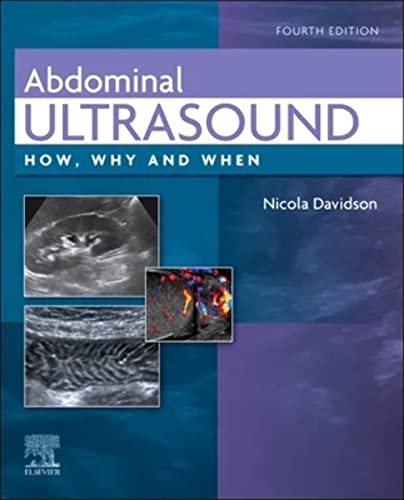 Book cover: "Abdominal Ultrasound" with ultrasound images and author Nicola Davidson.