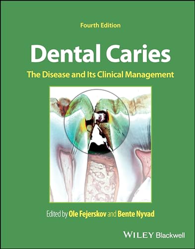 Book cover: "Dental Caries" with image of decayed tooth and text.