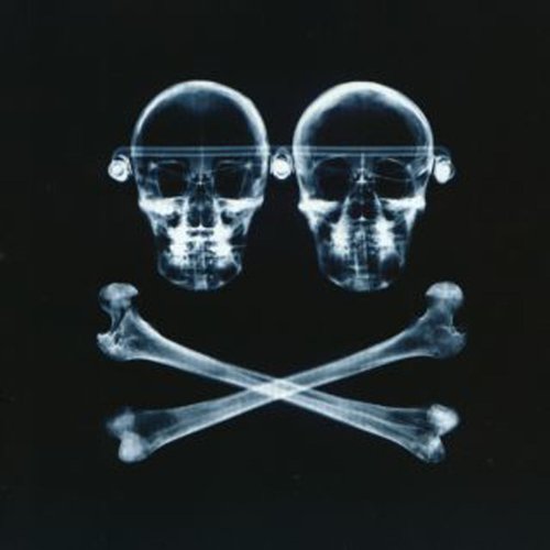 X-ray image of two skulls and crossed bones on black background.
