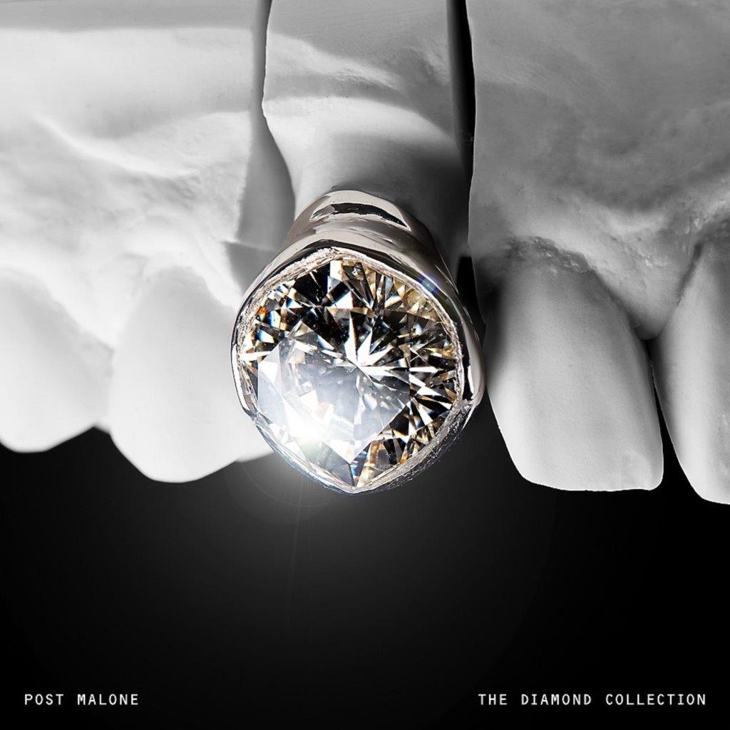 A large, sparkling diamond set in a tooth against a black background.