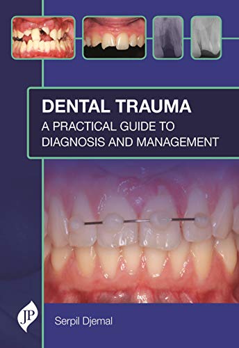 Book cover: "Dental Trauma" with images of injured teeth and dental work.