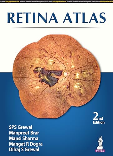 Book cover displaying a detailed, colorful image of the human retina.