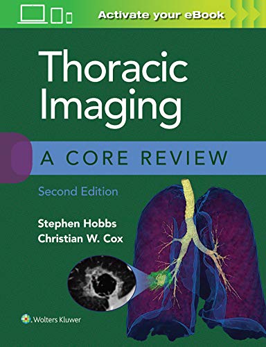 Book cover for “Thoracic Imaging: A Core Review,” second edition, with lungs.