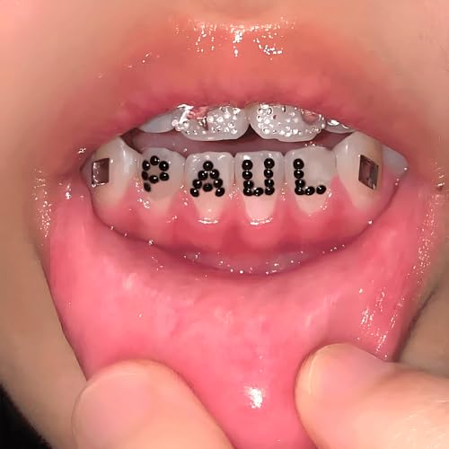 Close-up of lips with braces spelling "PAUL" with gem-covered teeth.