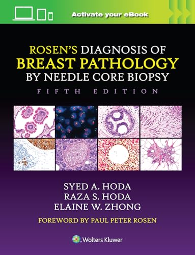 Book cover: "Rosen's Diagnosis of Breast Pathology," fifth edition, with microscopic images.