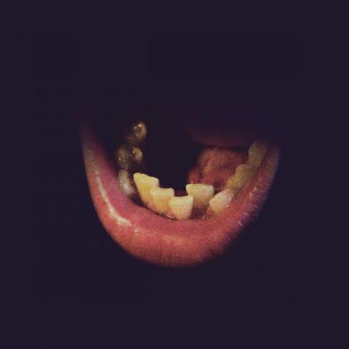 A vinyl record cover featuring a close-up of a mouth with gold-capped teeth.