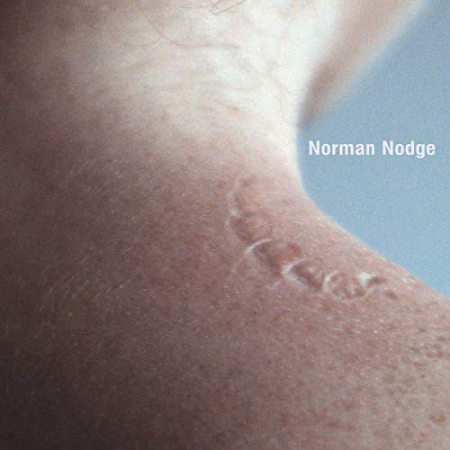 A close-up of a person's ankle with a scar, with "Norman Nodge" text overlay.