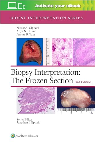 Biopsy Interpretation: The Frozen Section (Biopsy Interpretation Series)