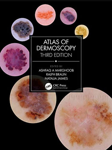 Atlas of Dermoscopy: Third Edition