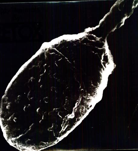 Retox - Ugly Animals [VINYL]