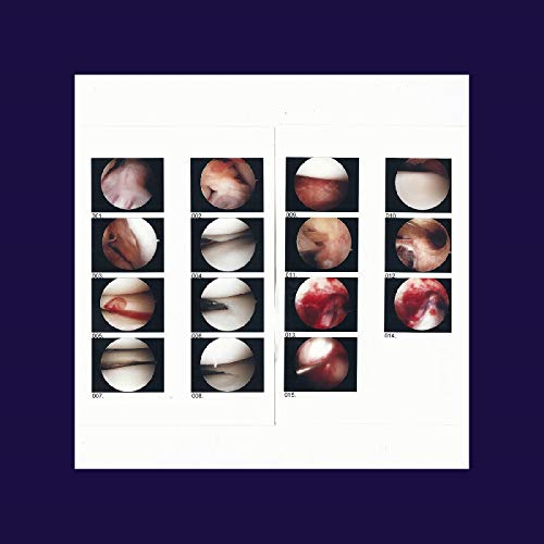 A white square with 14 close-up images of eyes on a dark blue background.