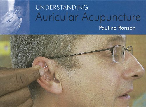 UNDERSTANDING AURICULAR ACUPUNCTURE