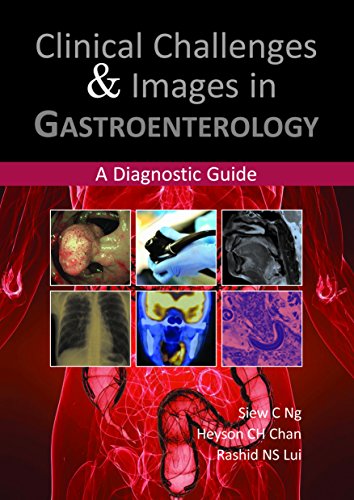 Clinical Challenges and Images in Gastroenterology