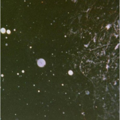 The image depicts a dark green background with white specks and dots. Alt text: Dark green background with scattered white dots and specks.