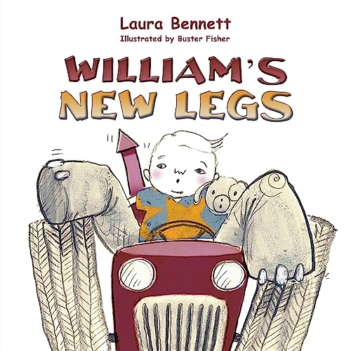 William's New Legs