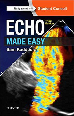 Echo Made Easy, 3e