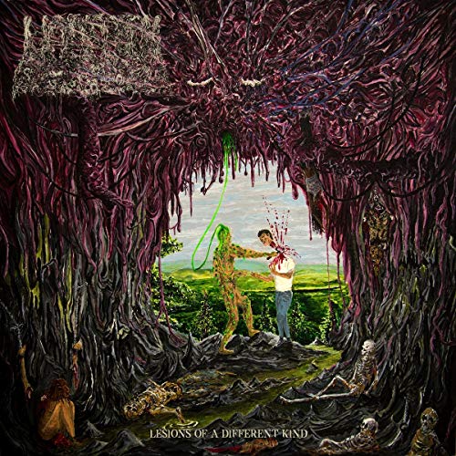 Undeath - Lesions of a Different Kind [CD]